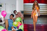 Hoa hậu Colombia xuất viện sau phẫu thuật cưa chân-3