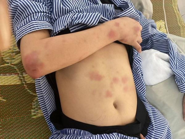 Gã đánh cô gái suốt 2 giờ đối mặt hình phạt nào?-2