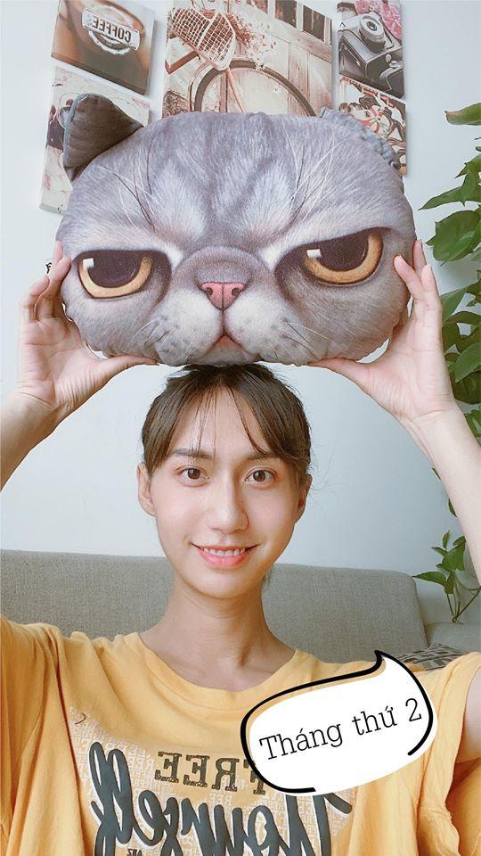 Lynk Lee công khai hình ảnh phẫu thuật thẩm mỹ, nhìn thôi đã đủ rùng mình-10