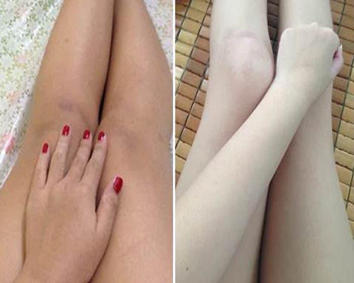 Sởn da gà với những cánh tay Bạch ma nữ nhờ kem trộn-7