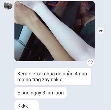 Sởn da gà với những cánh tay Bạch ma nữ nhờ kem trộn-6