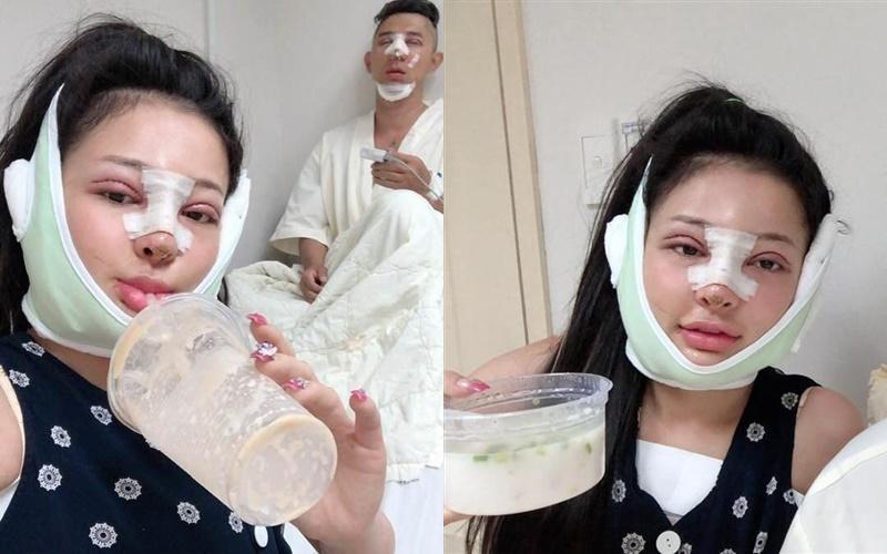 Loạt hình ảnh dàn sao Việt phẫu thuật thẩm mỹ gây nỗi sợ hãi đến ám ảnh-13