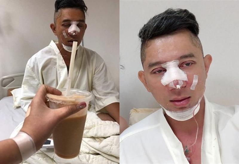 Loạt hình ảnh dàn sao Việt phẫu thuật thẩm mỹ gây nỗi sợ hãi đến ám ảnh-14