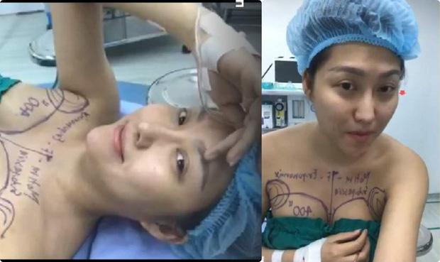 Loạt hình ảnh dàn sao Việt phẫu thuật thẩm mỹ gây nỗi sợ hãi đến ám ảnh-4