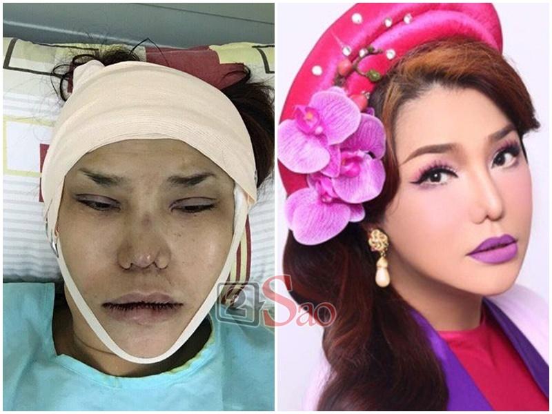 Loạt hình ảnh dàn sao Việt phẫu thuật thẩm mỹ gây nỗi sợ hãi đến ám ảnh-6