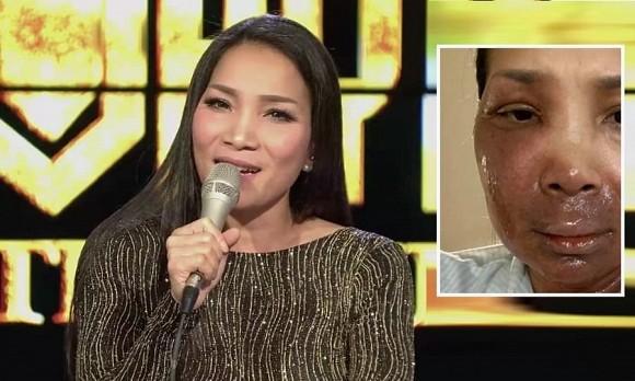 Hồng Ngọc khoe ảnh mới, không chỉ mặt mà tay và ngực cũng lành lặn diệu kỳ-1