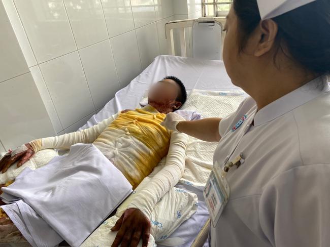 Thương tâm người phụ nữ Tiền Giang hoá thành ngọn đuốc sống vì bị nhân tình tưới xăng đốt-2