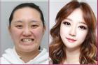 Tại sao người Hàn Quốc bất chấp rủi ro để phẫu thuật thẩm mỹ?