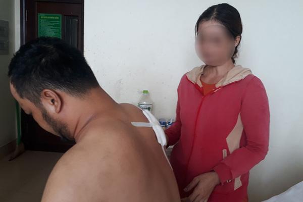 Người đàn ông bị 2 kẻ cầm súng xông vào nhà nghỉ lấy hung khí đâm thủng phổi-1