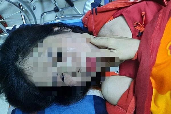 Điều tra người phụ nữ nghi bị chồng hờ bạo hành dã man-1