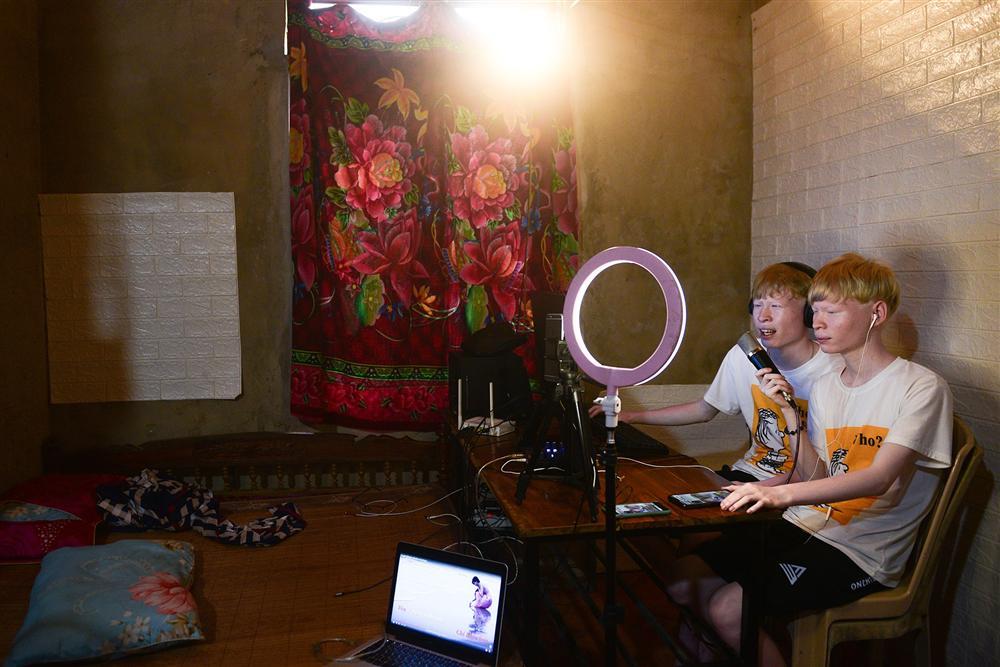 Thế giới riêng của cặp song sinh bạch tạng hiếm có ở Hà Tĩnh-5