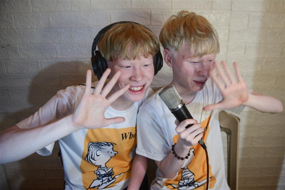 Thế giới riêng của cặp song sinh bạch tạng hiếm có ở Hà Tĩnh-6