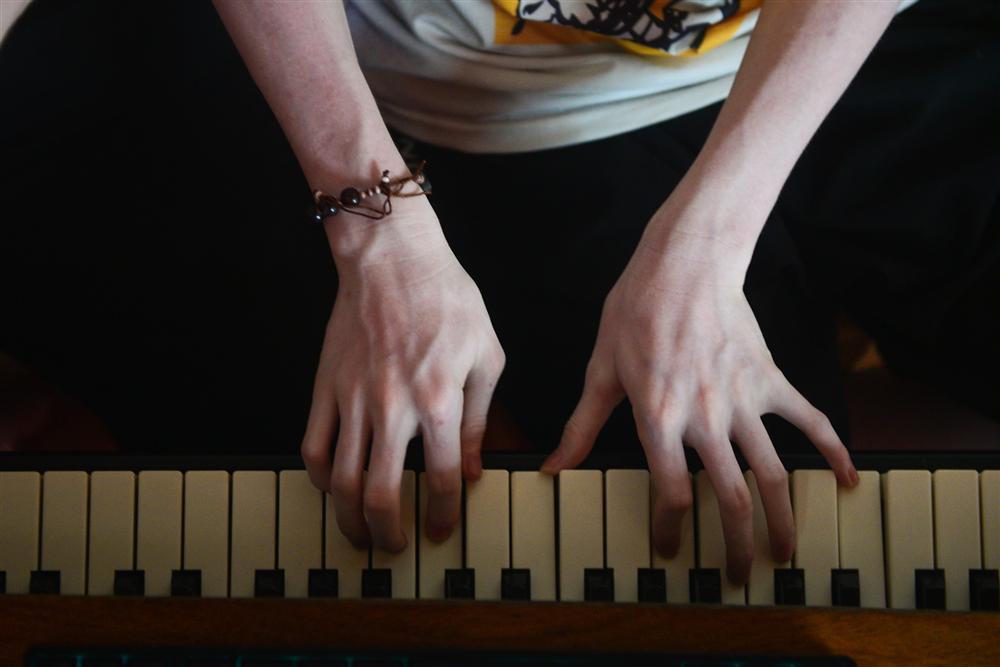 Thế giới riêng của cặp song sinh bạch tạng hiếm có ở Hà Tĩnh-7