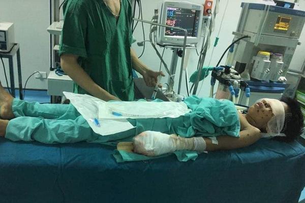 Vừa sạc điện thoại vừa dùng, nam thanh niên Quảng Bình cháy bỏng toàn thân-2