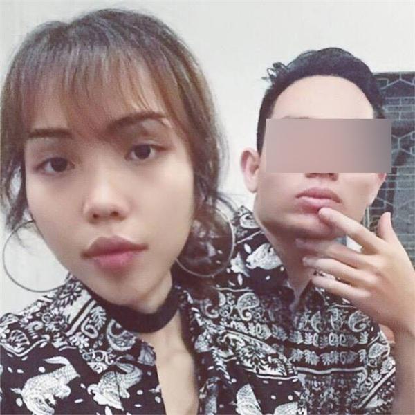 Gương mặt cô gái Đà Nẵng bị chồng sắp cưới tạt axit đến biến dạng hồi phục thần kì-1