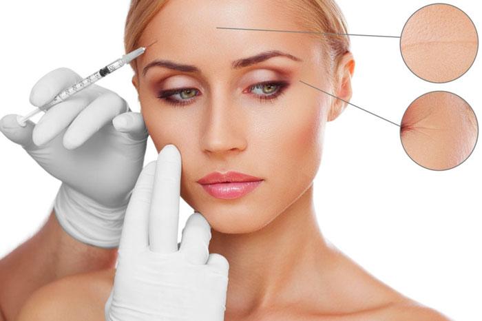 Hàng loạt trường hợp da nổi sần đỏ thành hàng vì tiêm tế bào gốc để trẻ hóa làn da-3