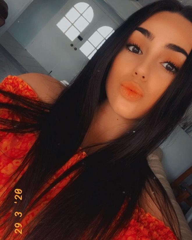 Gương mặt 10X thành hình vuông vì đi hút mỡ cằm-2