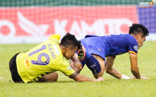 Quang Hải đổ máu trên sân cỏ giữa ồn ào nhún nhảy Hồ Tây-1