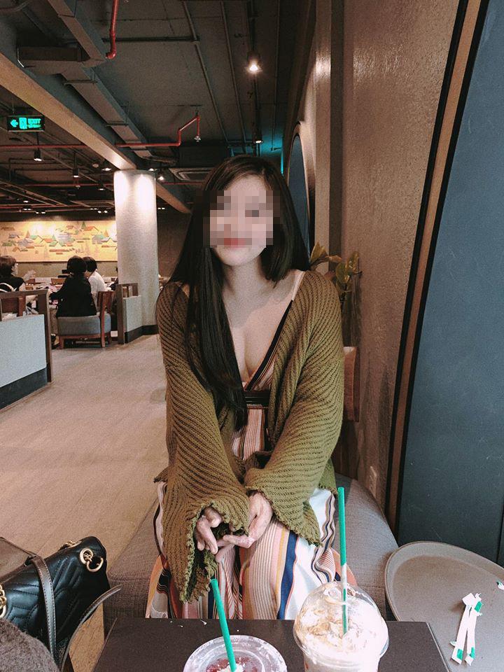 Nghị lực sống phi thường của cô giáo trẻ từng tai nạn bỏng nặng toàn thân-1