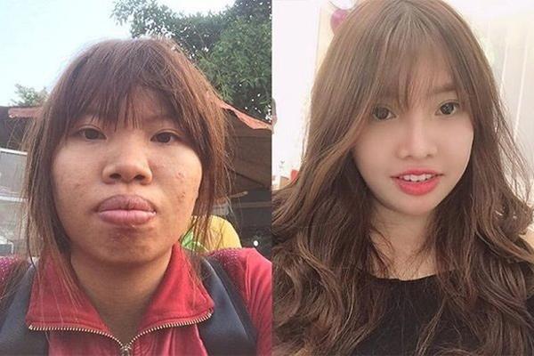 Bị chê bai quá khứ kém sắc, Thị Nở Quách Phượng liền công khai loạt ảnh xấu xí trước thẩm mỹ-7