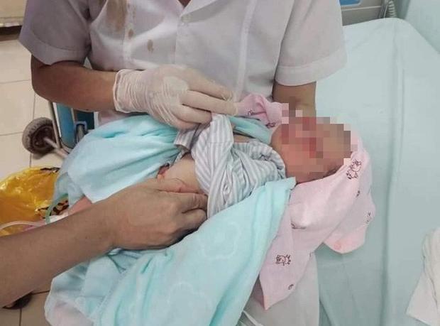 Thông tin mới nhất về tình hình sức khỏe của bé sơ sinh bị bỏ rơi 3 ngày dưới hố gas ở Hà Nội-1