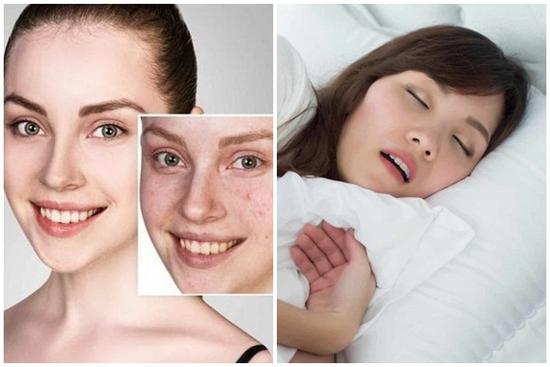 Mụn đầu đen, lỗ chân lông to, chỉ cần thực hiện ba bước đơn giản để có làn da láng mịn