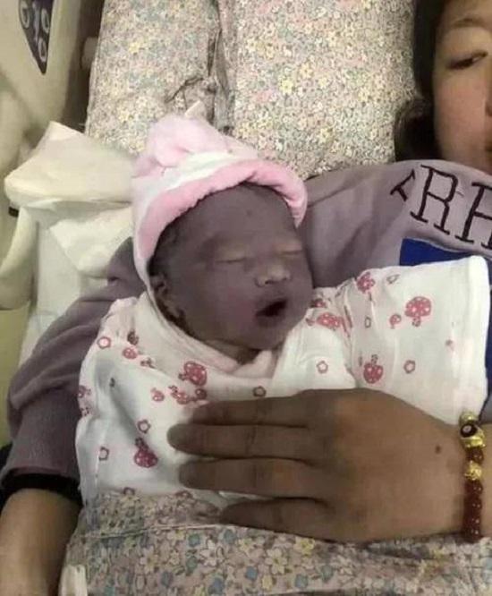 Mẹ muốn khóc khi con gái mới sinh trông như củ khoai môn, 3 tháng sau bé có pha thay đổi ngoại hình khiến ai cũng ngỡ ngàng-1