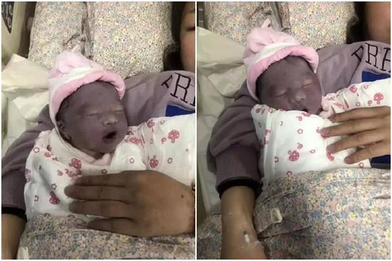 Mẹ muốn khóc khi con gái mới sinh trông như 'củ khoai môn', 3 tháng sau bé có pha thay đổi ngoại hình khiến ai cũng ngỡ ngàng