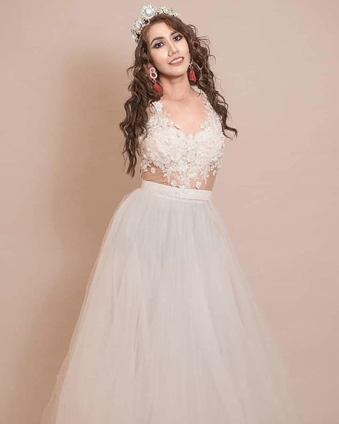 Cô gái cụt hai tay từ khi chào đời lọt vào chung kết hoa hậu-3