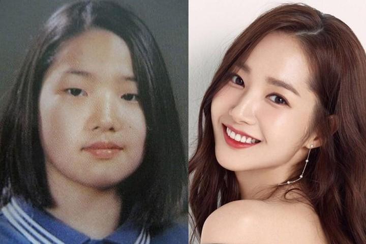 Chi 400 triệu thẩm mỹ thành hotgirl, 9X Sài Gòn giờ không dám mang bầu-5