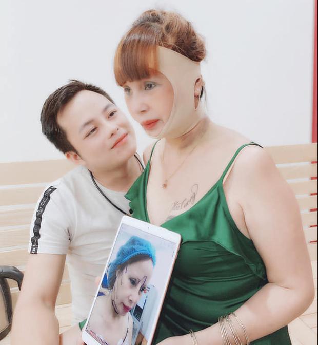 Miệng méo lệch mặt sau 4 ngày dao kéo, cô dâu Cao Bằng lo lắng biến chứng-4