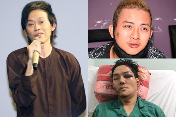 Danh hài Hoài Linh bị gà đá đến chảy máu chân, sa sẩm mặt mũi-4