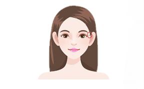 4 nốt ruồi cay đắng trên mặt phụ nữ, hôn nhân thường trục trặc, dễ cô đơn cả đời-1