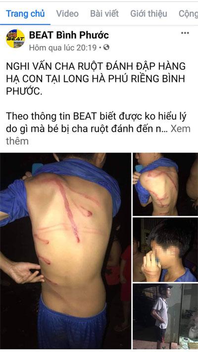 Công an tỉnh Bình Phước thông tin vụ cha bạo hành con ruột-1