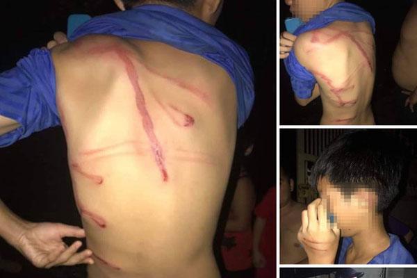 Diễn biến mới nhất vụ gã cha dượng bạo hành dã man bé gái 4 tuổi-2