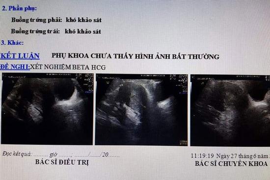 Vụ vác bụng đi đẻ ... nhưng không có thai: Siêu âm không có thai nhưng 'con' vẫn đạp trong bụng?