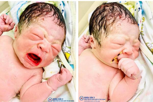 Câu chuyện phía sau hình ảnh em bé sơ sinh cầm trên tay vòng tránh thai gửi trả bố mẹ-1