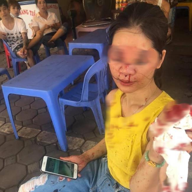 Sự thật nữ khách hàng bị thẩm mỹ viện Venus gọi giang hồ đánh chảy máu mặt vì đòi bảo hành-1