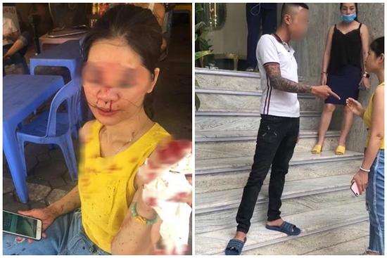 Sự thật nữ khách hàng bị thẩm mỹ viện Venus gọi giang hồ đánh chảy máu mặt vì đòi bảo hành