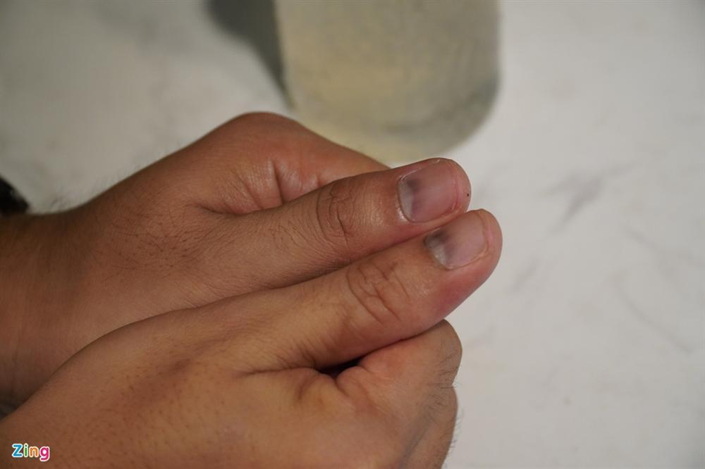 Diễn viên Đức Thịnh: Qua 5 bệnh viện mới biết mình bị ung thư-4