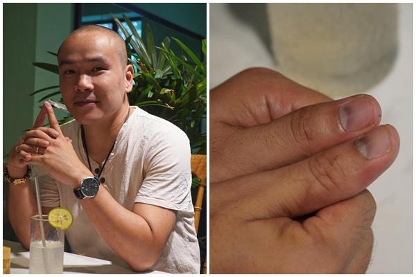 Thêm 1 nạn nhân thánh thực dưỡng tự phong: Cái chết tức tưởi của bé gái 30 tháng tuổi-2