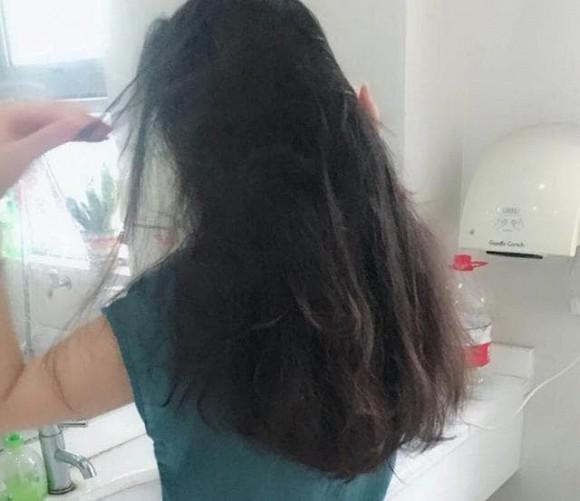 5 thói quen xấu khiến ngôi tóc to và đường chân tóc mọc về phía sau như hói, thậm chí rụng tóc liên tục-3