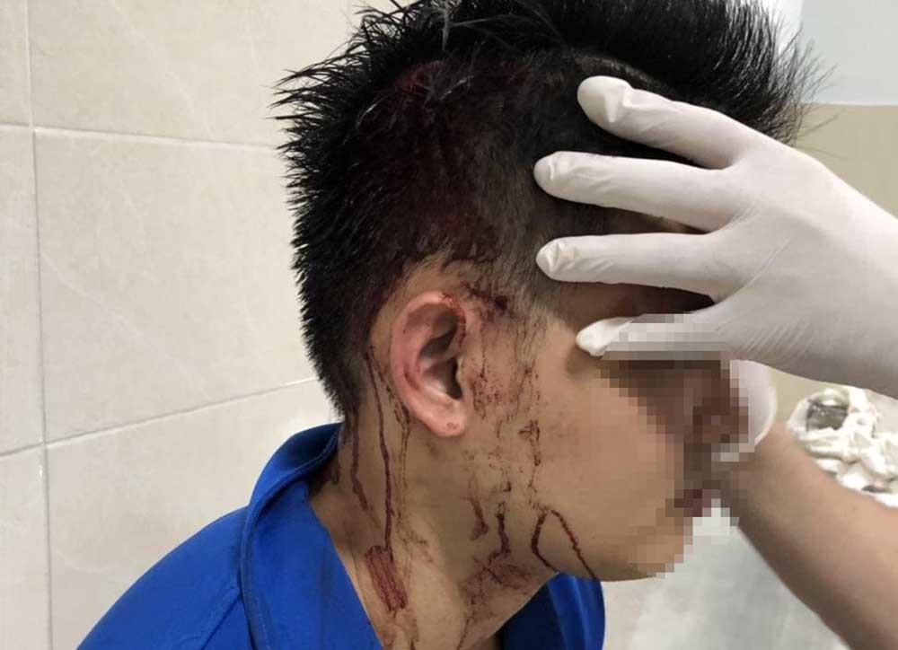 Nổ súng trong hỗn chiến ở Sài Gòn-1