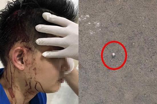 Nổ súng trong hỗn chiến ở Sài Gòn