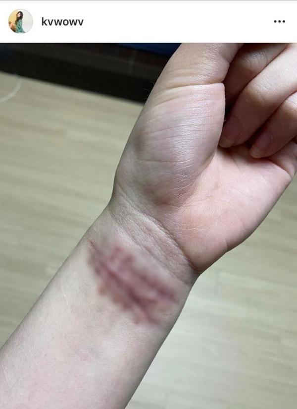 Mina từng uống 200 viên thuốc ngủ vì Jimin, là bạn thân của nghệ sĩ quá cố Sulli-3