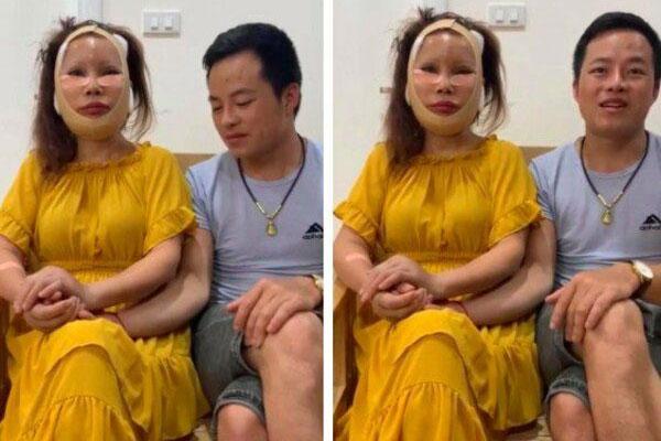 Mới căng da mặt, cô dâu Cao Bằng lại muốn trùng tu vòng 1: Có quá vội vàng?-1