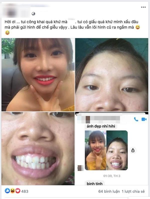 Bị chê bai quá khứ kém sắc, Thị Nở Quách Phượng liền công khai loạt ảnh xấu xí trước thẩm mỹ-2