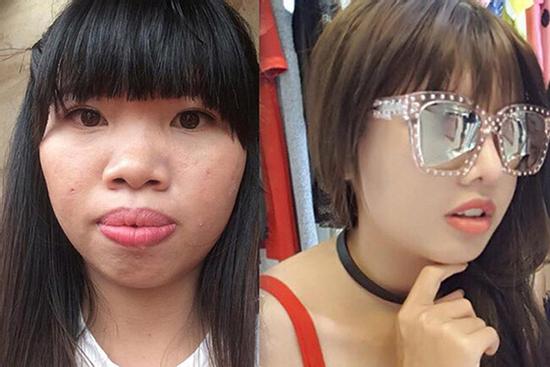 Bị chê bai quá khứ kém sắc, 'Thị Nở' Quách Phượng liền công khai loạt ảnh 'xấu xí' trước thẩm mỹ