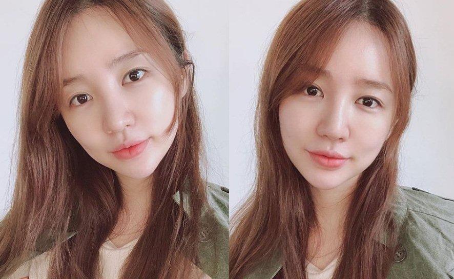 Mới đây, Yoon Eun Hye chia sẻ loạt ảnh mặt mộc lên Instagram cá nhân. Có thể thấy, sau những hình ảnh mặt cứng đờ do phẫu thuật thẩm mỹ, nàng 