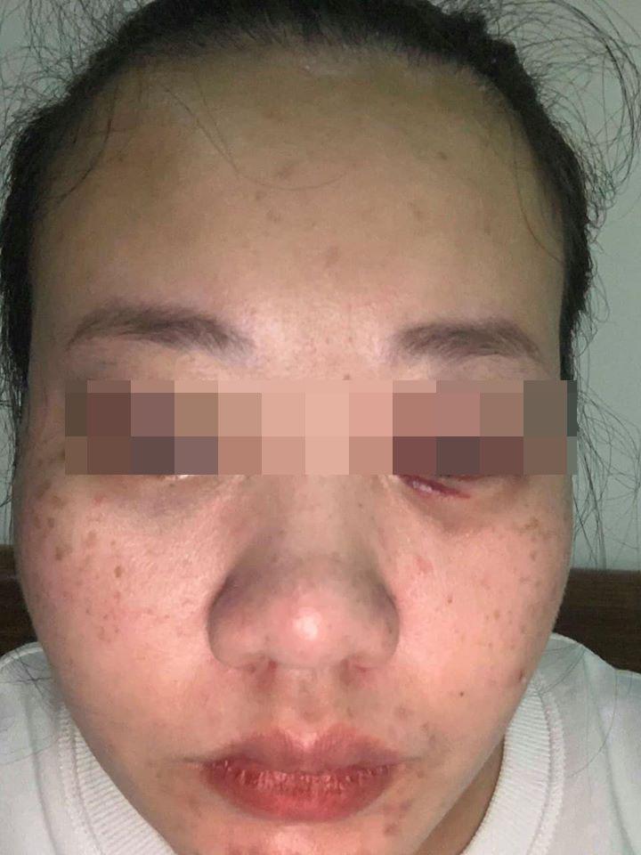 Xôn xao vụ mẹ bỉm vừa sinh con đã bị cả nhà chồng chửi vô dụng, bắt xét nghiệm ADN cho đến khi có kết quả thì tiếp tục trở mặt-3